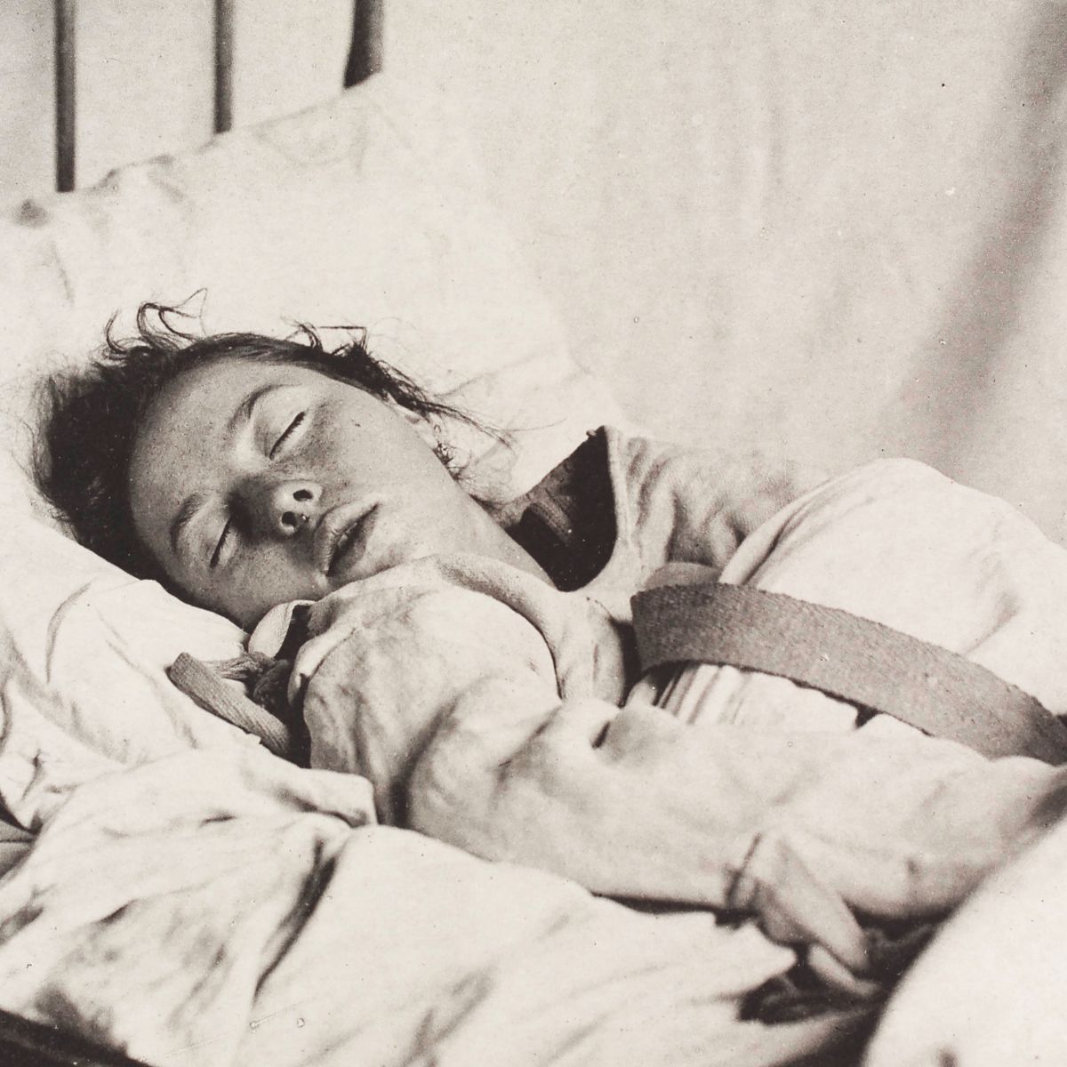 Histeria: cuando el útero viajaba por el cuerpo y volvía 'locas' a las mujeres